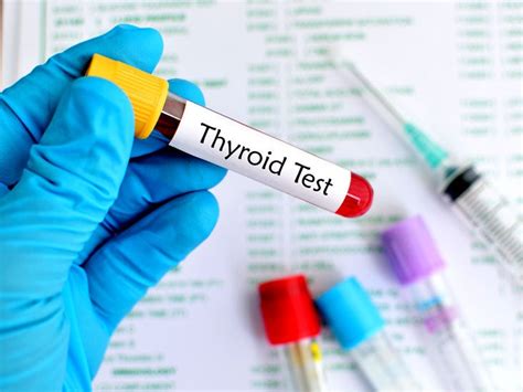 thyroid blood test bottle colour|thyroid stimulating hormone blood test.